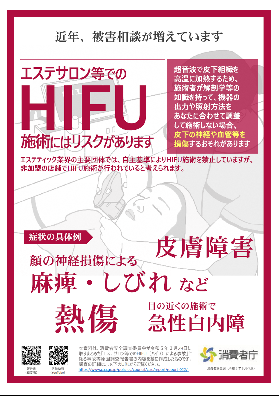 HIFU注意喚起1 HIFU施術での症状の具体例が記入されています。皮膚障害・麻痺・しびれ・急性白内障など